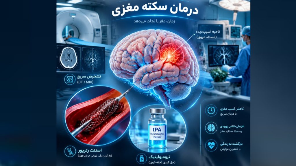 روش های درمان سکته مغزی چیست؟